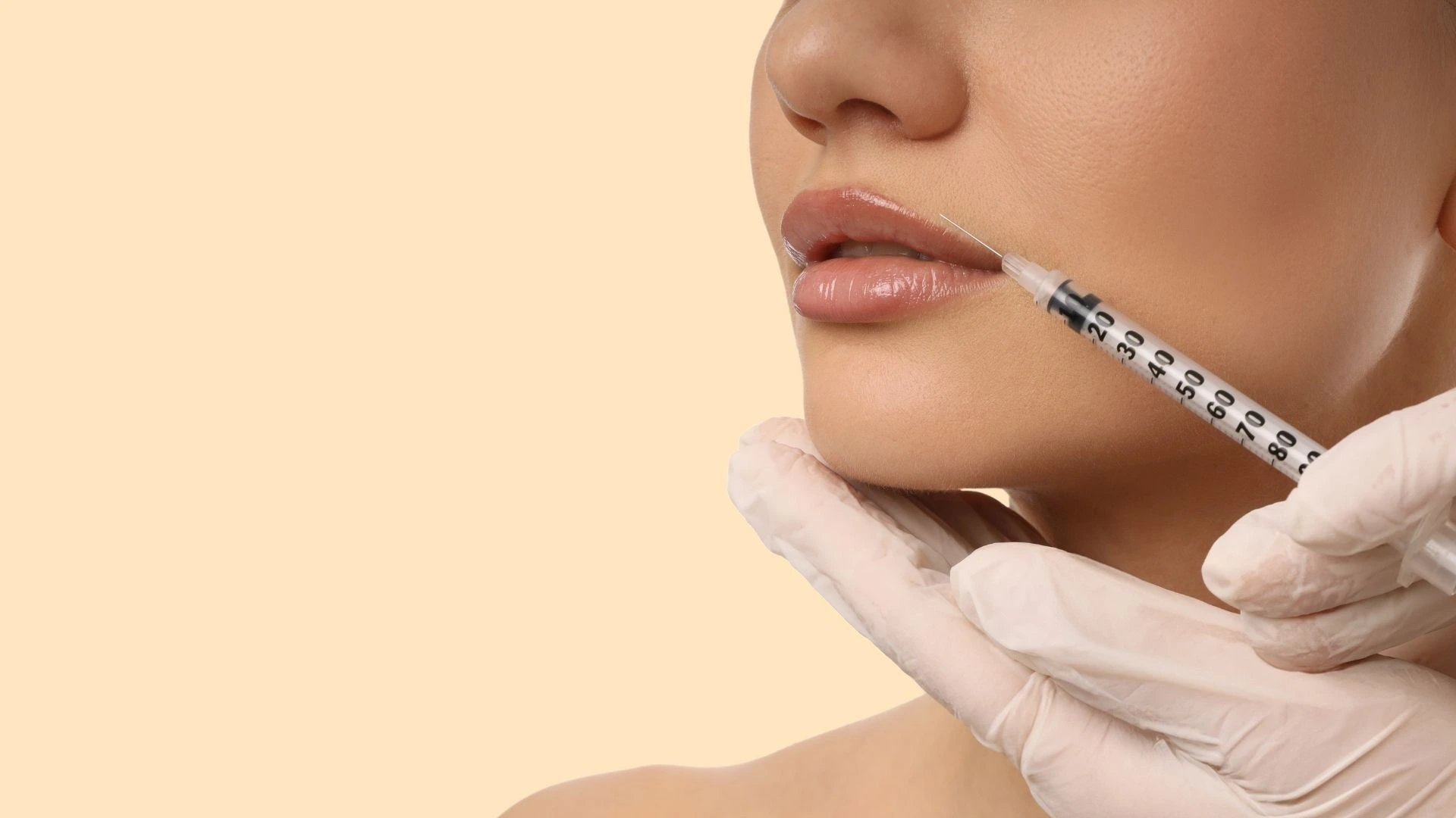 Yüz ve Dudak Dolgusu Nedir? Dolgu İşlemi Nasıl Yapılır? Güvenli ve Etkili Uygulama Teknikleri